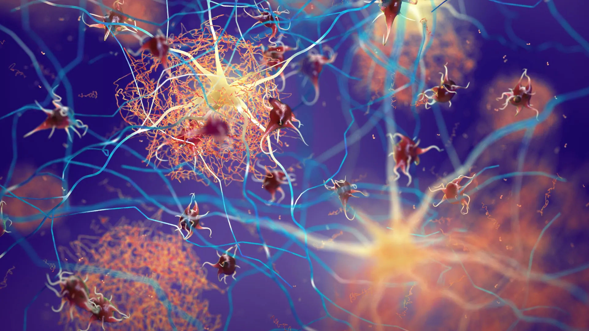 Hidden Alzheimer’s warning signs found in Parkinson’s patients without dementia